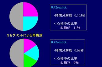 %e3%82%bb%e3%82%b0%e3%83%a1%e3%83%b3%e3%83%88%e5%86%8d%e6%a7%8b%e6%88%90%e6%b3%95%e3%81%a8%e6%99%82%e9%96%93%e5%88%86%e8%a7%a3%e8%83%bd%e3%81%ae%e9%96%a2%e4%bf%82%e3%81%a8%e3%81%af%ef%bc%9f-2