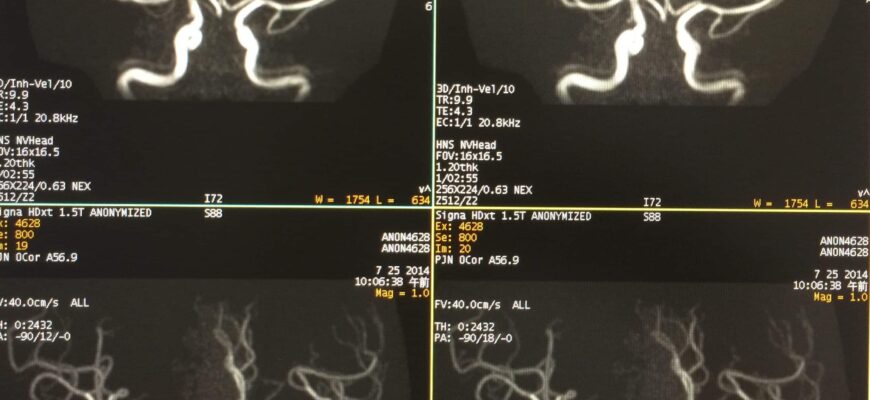 mri%e5%8e%9f%e7%90%86%e2%91%b1%ef%bc%9amra%e3%81%aetof%e3%81%a8%e3%81%af%ef%bc%9f-2