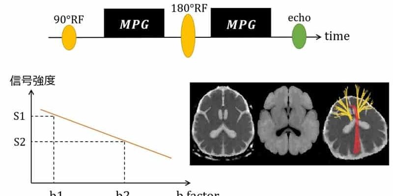 mri%e5%8e%9f%e7%90%86%e2%91%af%ef%bc%9aepi%ef%bc%88%e3%82%a8%e3%82%b3%e3%83%bc%e3%83%97%e3%83%a9%e3%83%8a%e3%83%bc%e6%92%ae%e5%83%8f%e6%b3%95%ef%bc%89%e3%81%a8%e3%81%af%ef%bc%9f-2