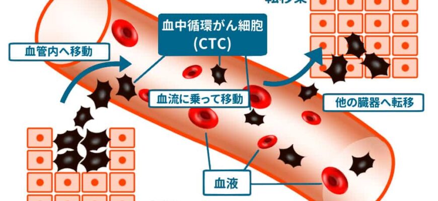 ctc%e6%a4%9c%e6%9f%bb%e3%81%a8%e3%81%af%ef%bc%9f%e3%81%aa%e3%81%ab%e3%81%99%e3%82%8b%e3%81%ae%ef%bc%9f-2