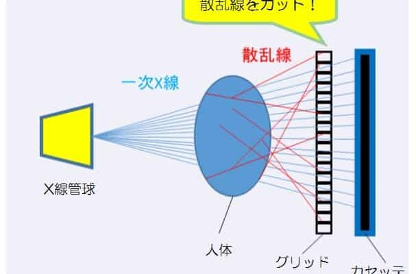 管電流と照射時間の関係とは ギモンらど